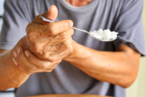 Parkinson-Demenz: Symptome umfassend beurteilen