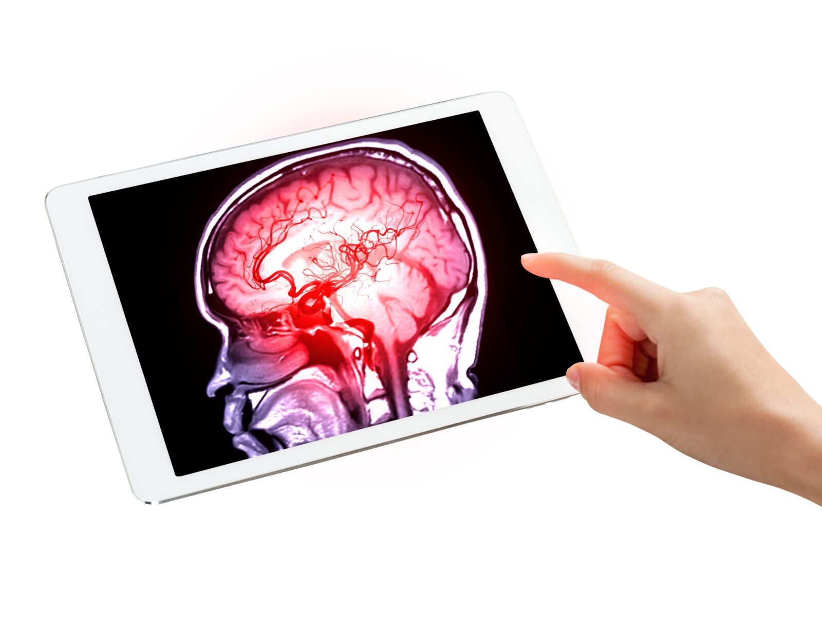 Vaskuläre Demenz: Eine unterschätzte Gefahr